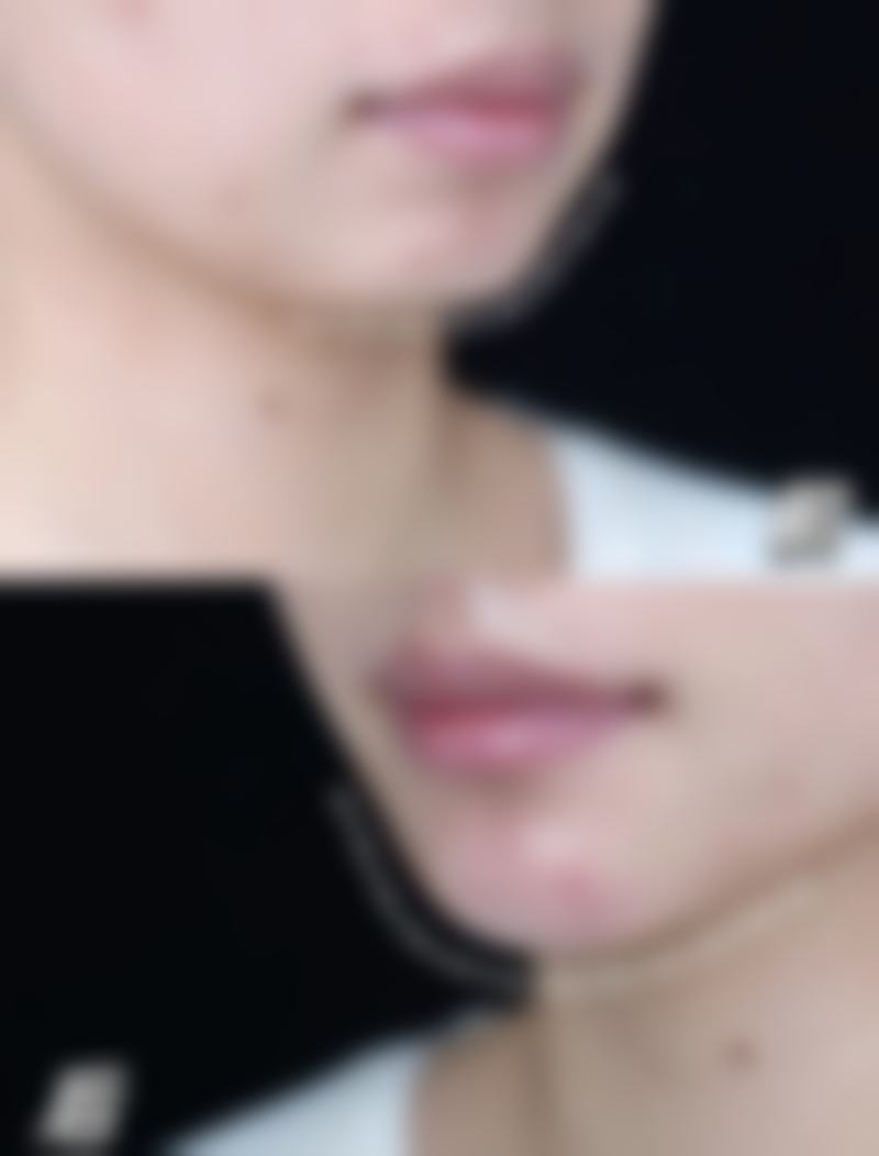 八、广元医而美美华医疗美容整形门诊部真实的顾客评价如下: