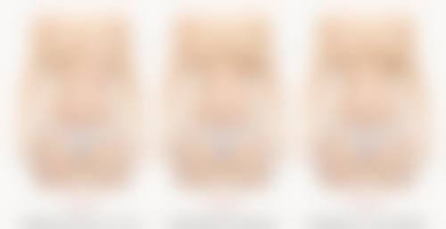 自体脂肪隆胸改善胸部下垂，术后要注意啥？