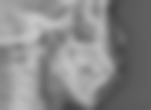 金铮治疗白癜风水平怎么样可靠吗？