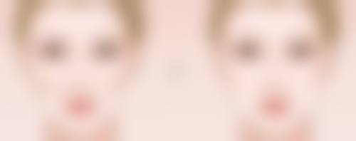 大腿抽脂究竟能瘦多少厘米？揭秘不同抽脂量下围度减少的显著效果 