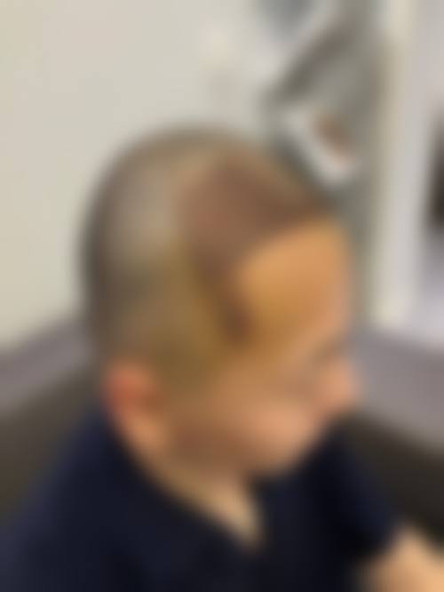 曹长源治疗白癜风水平怎么样可靠吗?