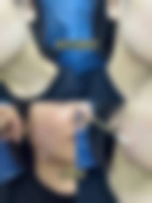 付崇华面部整形手术水平怎么样可靠吗？