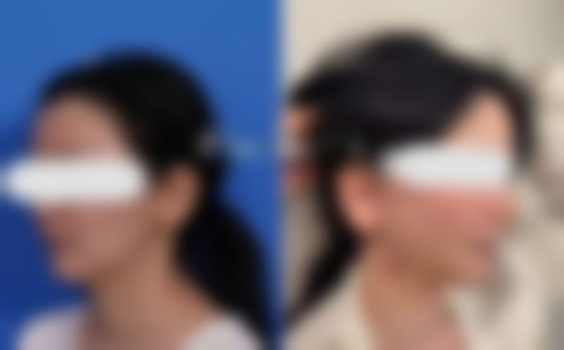 陈秀芸怎么预约?