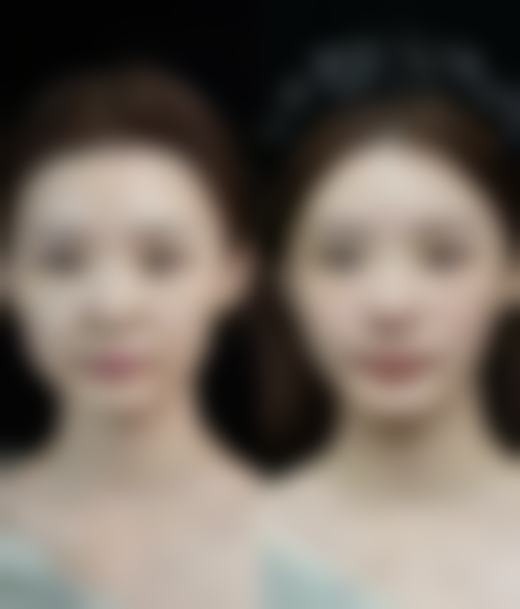 四、海口碧莲盛植发医院实例