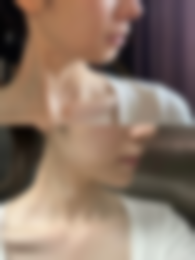 VE不能直接去除眼袋但能改善眼周！揭秘正确使用方法及科学去眼袋方案 