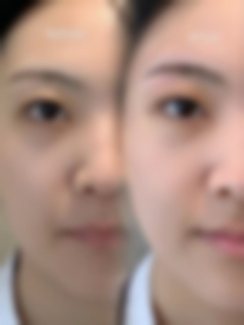 杨宏洲面部轮廓水平怎么样可靠吗?