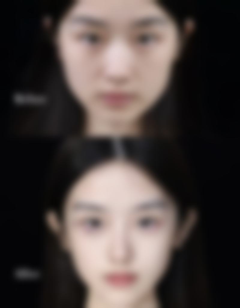 选择合适的医院进行激光治疗