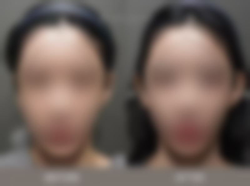 四、上海浦东新区摩尔齿科整形(曲阳路店)实例