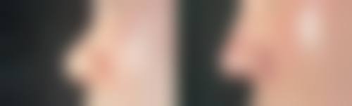 四、北京京喜医疗美容诊所实例