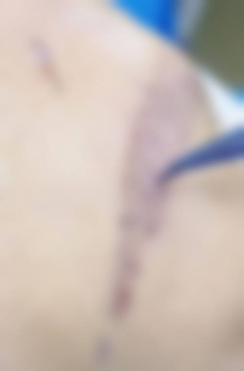 安娜项目价格表参考