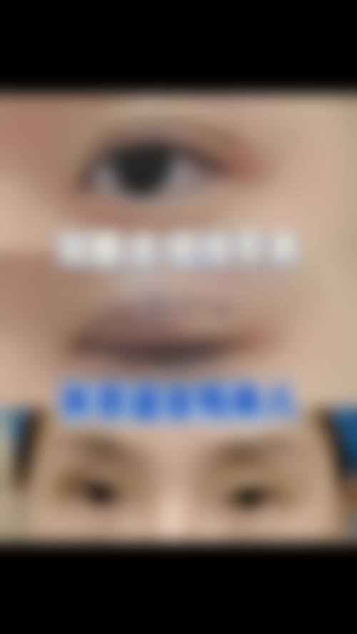 熊浩五官整形水平怎么样可靠吗？