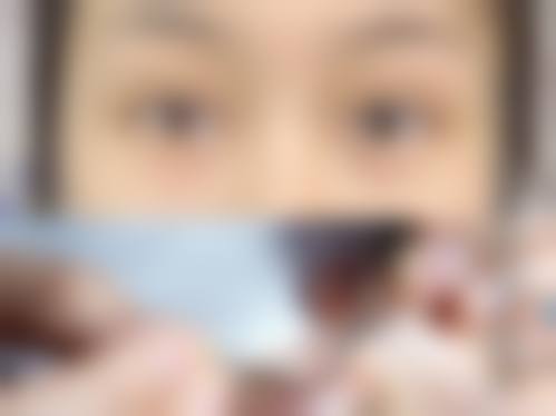 熊浩五官整形实例