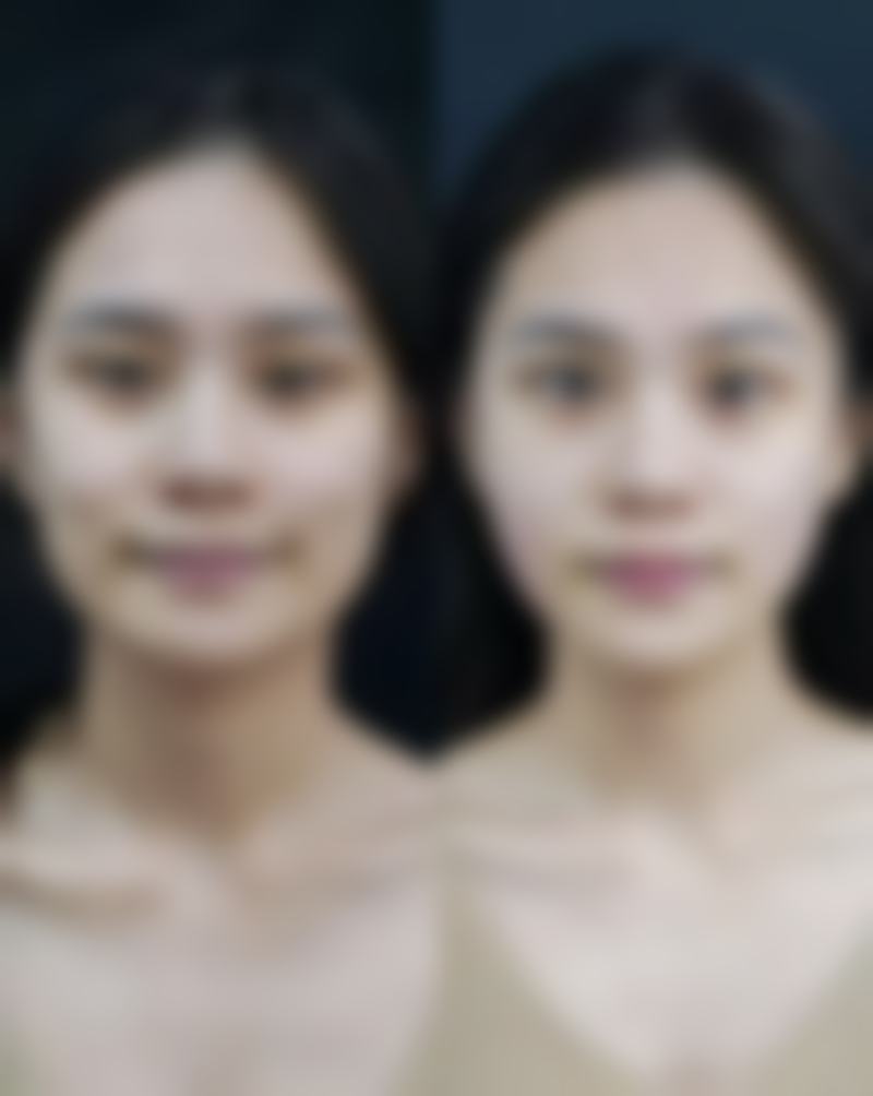 想治疗成效好?这些美学提示和注意事项别忽略