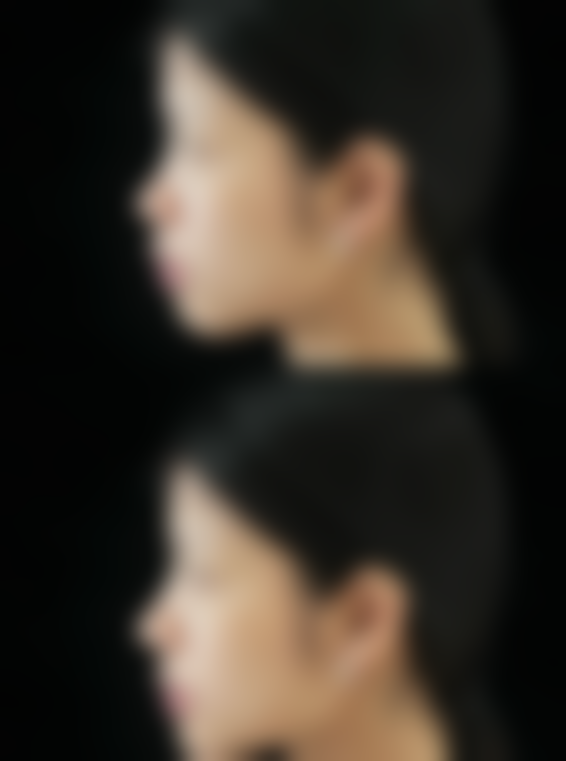 血压高变得更美方案多，总有一款适合你