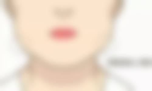 假体隆胸优势多，美丽自信不是梦