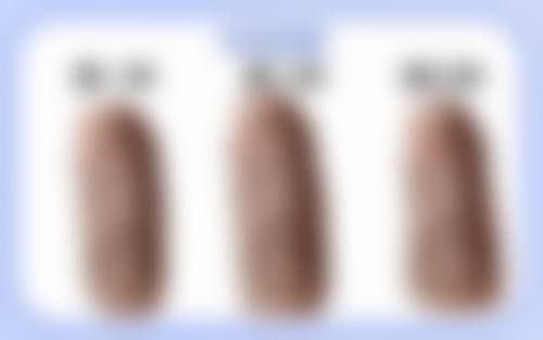 快速攻克疤痕疙瘩难题！选择靠谱医院特别重要