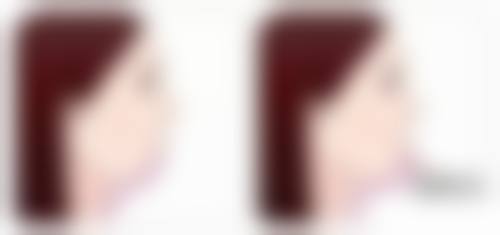 六、靖江皇开医疗美容诊所价格表：（仅供参考）