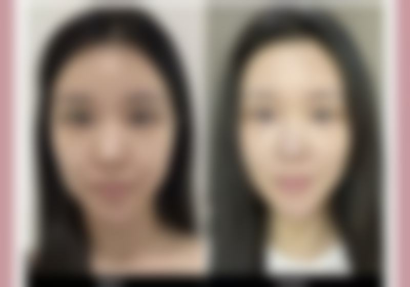 五、靖江皇开医疗美容诊所怎么预约：