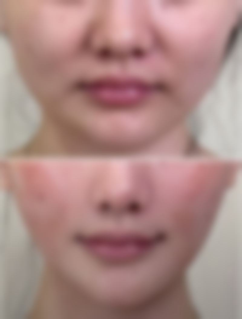 六、宁德焕颜整形医院价格表：（仅供参考）