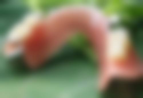 做完双眼皮肿成“悲伤蛙”？掌握冷热交替、饮食调理等妙招快速消肿 