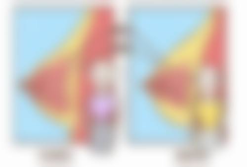 手术去眼袋有哪些潜在危害？了解风险，从专业医院与医生技术保障开始 