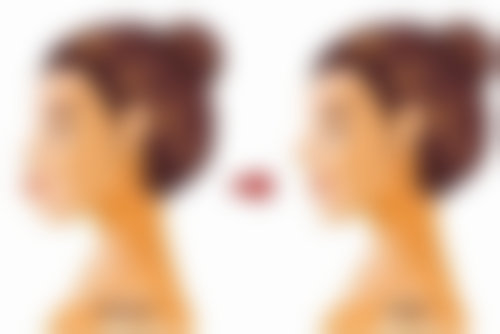 不同类型圆脸，适配不同改善方案