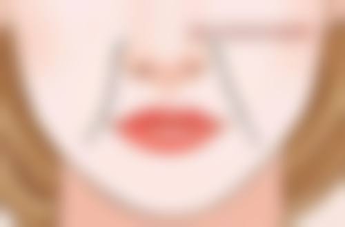 割双眼皮后美学与修复平衡,美丽锻炼两不误