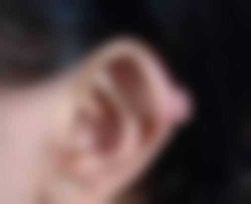 自体脂肪与假体隆胸谁更安全？从适用人群、恢复周期等多维度剖析两者优势 