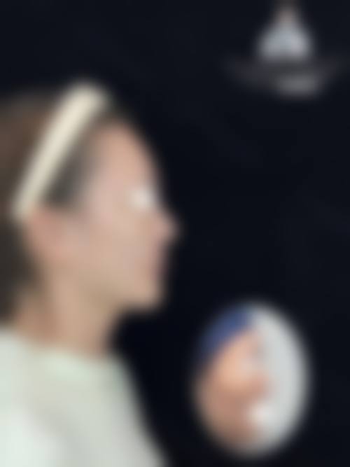 黄雪琴在哪家医院