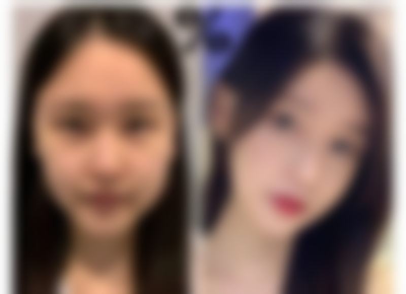 六、日本百人町(アルファ)阿尔法医院怎么预约: