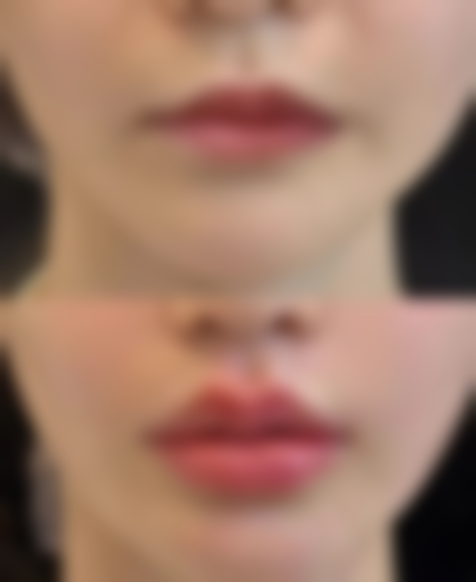 六、武汉东西湖首秀整形医院价格表：（仅供参考）