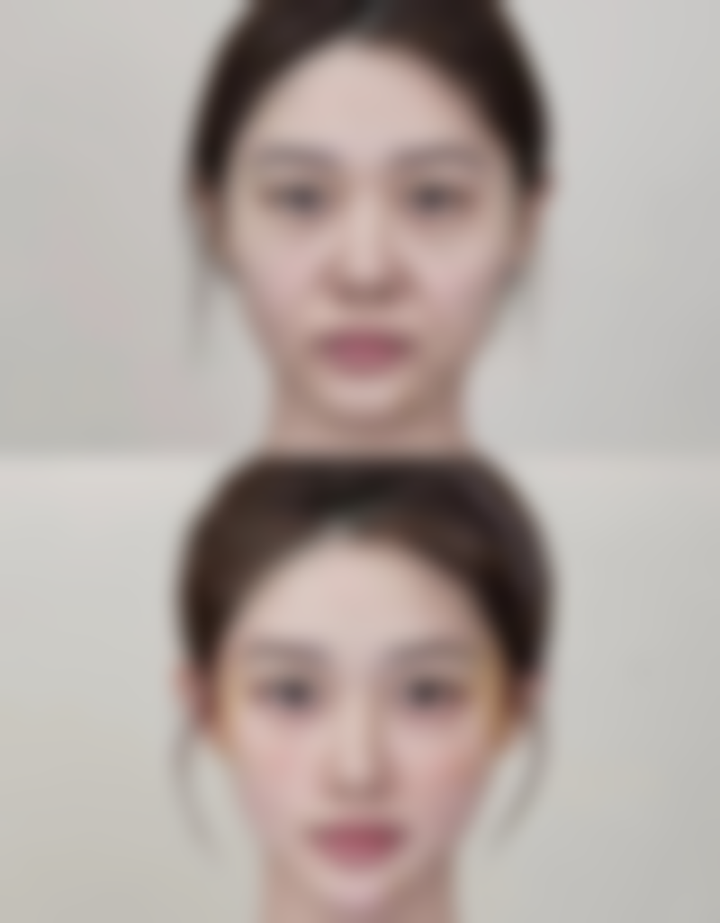 六、昆山米扬丽格医疗美容怎么预约：