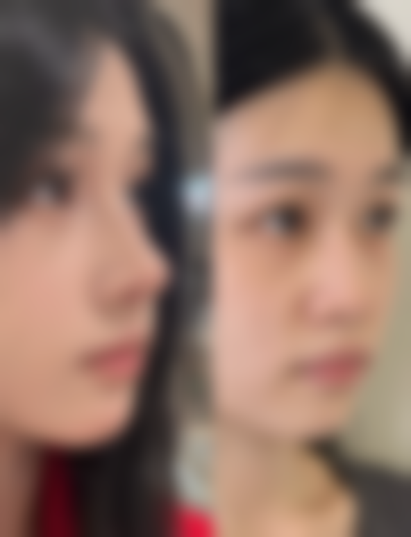 六、杭州上正整形医院价格表:(仅供参考)