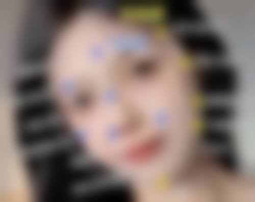 六、韩国snow整形外科怎么预约：