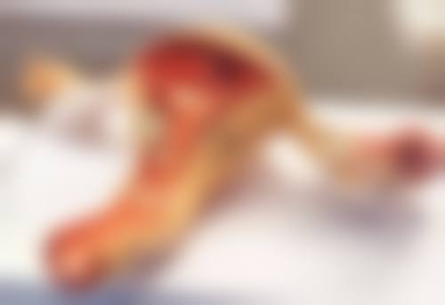 乳房大能否抽脂？选对医院特别重要