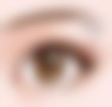 正规医院：为取假体隆胸安心护航