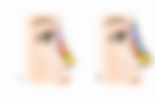 四、南京安安医疗美容实例