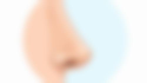 甲状腺手术后疤痕增生别慌!优质医院来帮忙