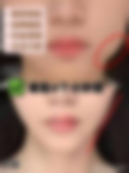 徐源弘项目价格表参考