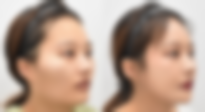 谭茜在哪家医院