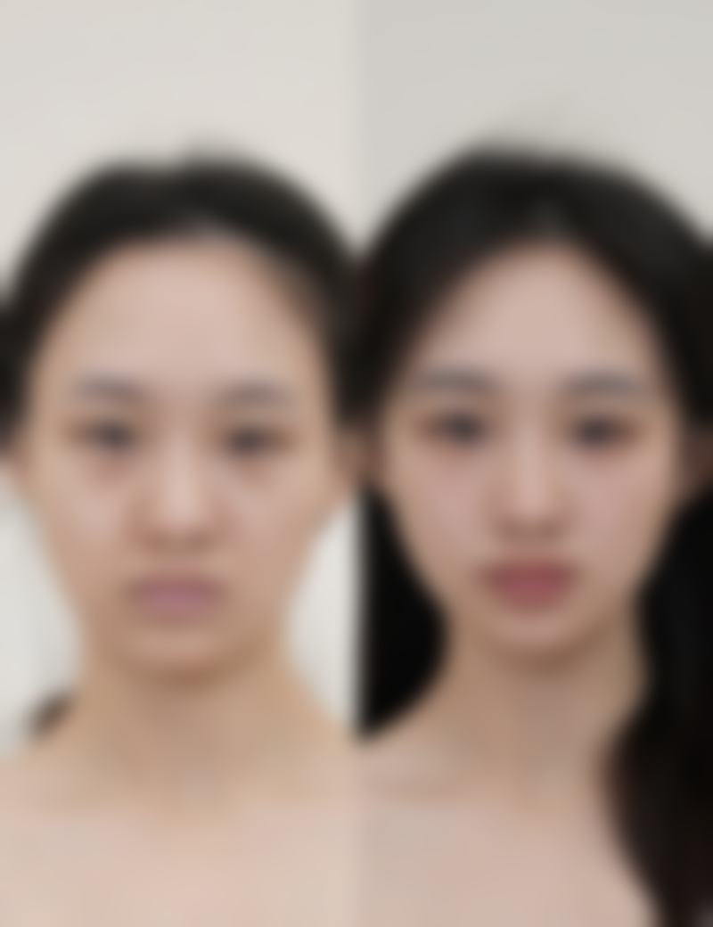 七、成都慕臻颜医疗美容诊所价格表:(仅供参考)