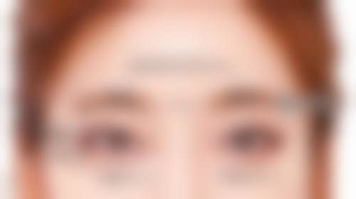 徐源弘眼部整形水平怎么样可靠吗?