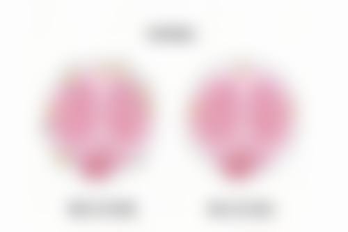 割过双眼皮留疤不愁!日常护理助力理想修复