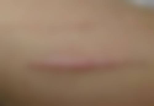 七、合肥崔劲松整形医院价格表：（仅供参考）