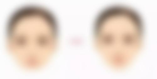 放心美丽选择:正规手术安心升级