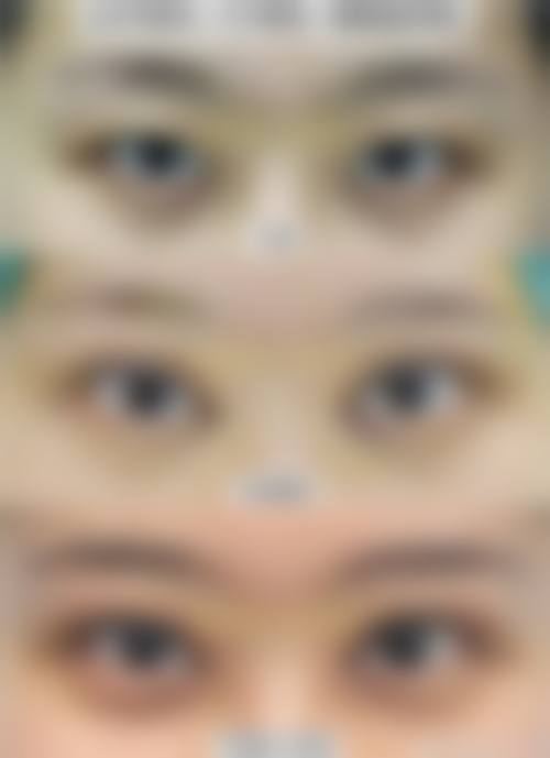 曾焕洪面部年轻化雕塑水平怎么样可靠吗？