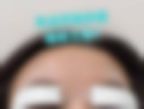 曾焕洪面部年轻化雕塑实例