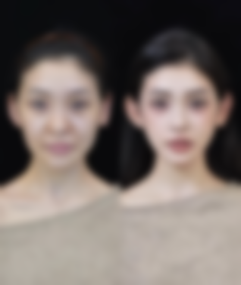 打瘦脸针后，控制钠盐摄入有多重要？