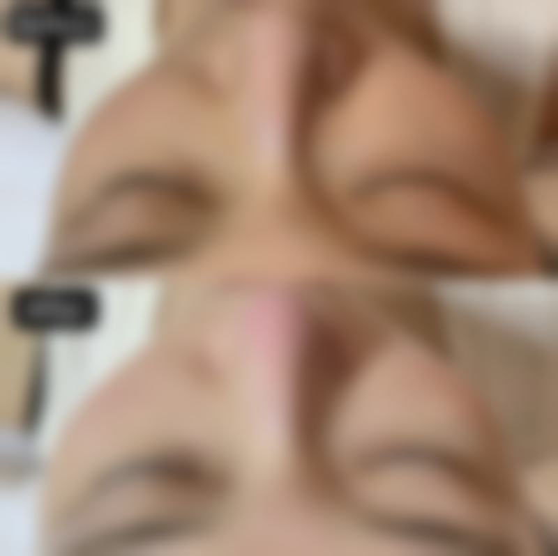 八、合肥崔劲松整形医院真实的顾客评价如下：