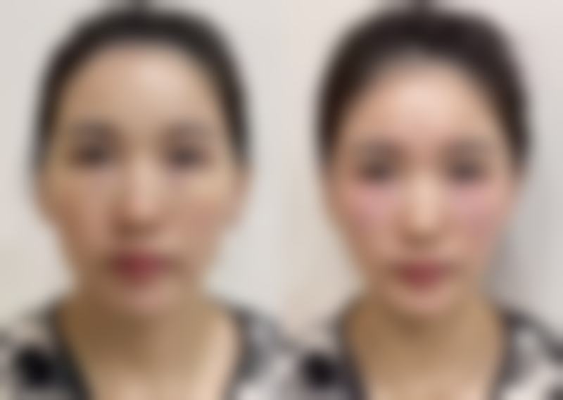 七、台州兰海荣医疗美容诊所真实的顾客评价如下：